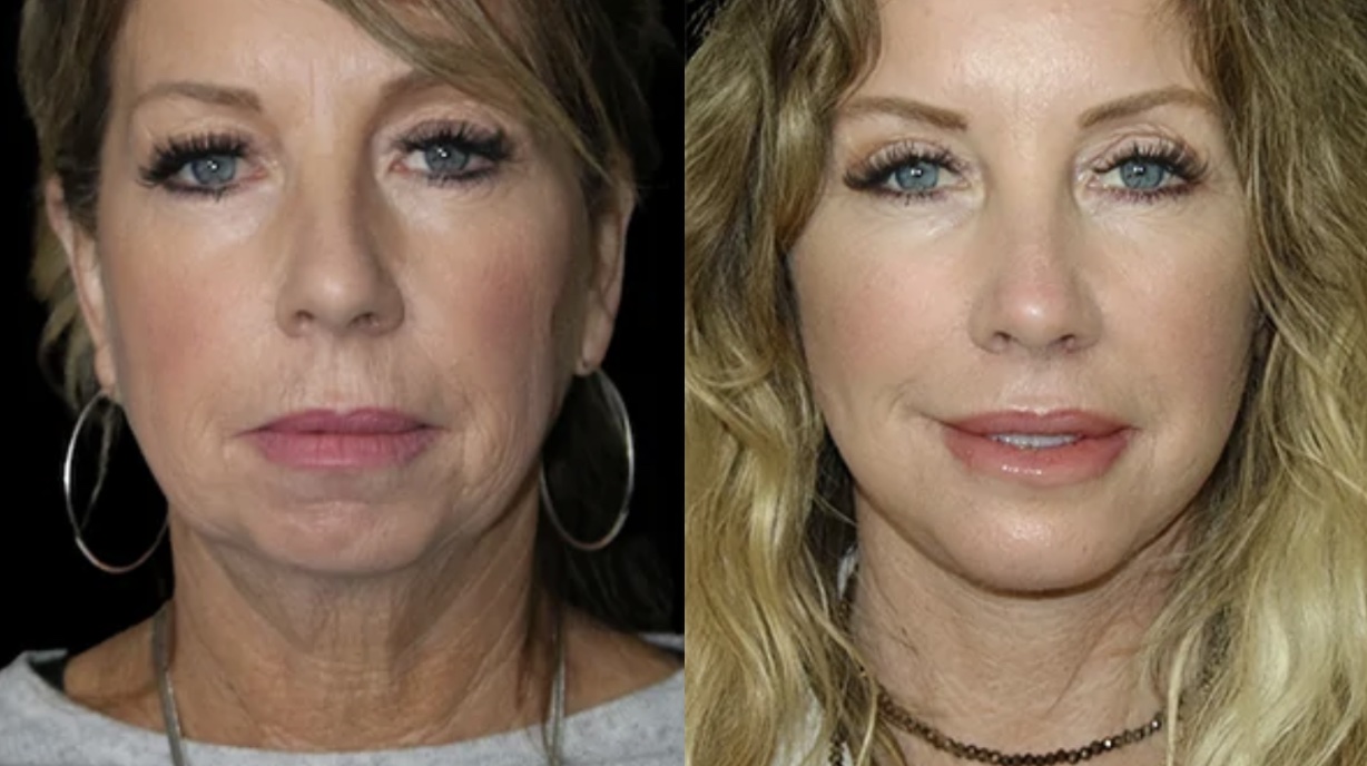 Screenshot 2024 07 19 at 1.46.24 PM